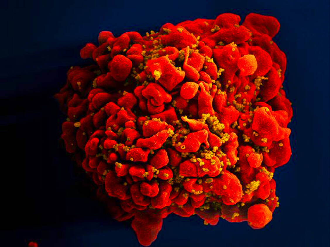 HI-Viren werden aus einem infizierten T-Lymphozyten freigesetzt. Das kann der neue Arzneistoff Fostemsavir nicht verhindern. Er blockiert das Eindringen von HIV in noch nicht infizierte Zellen. / Foto: National Institute of Allergy and Infectious Diseases (NIAID)