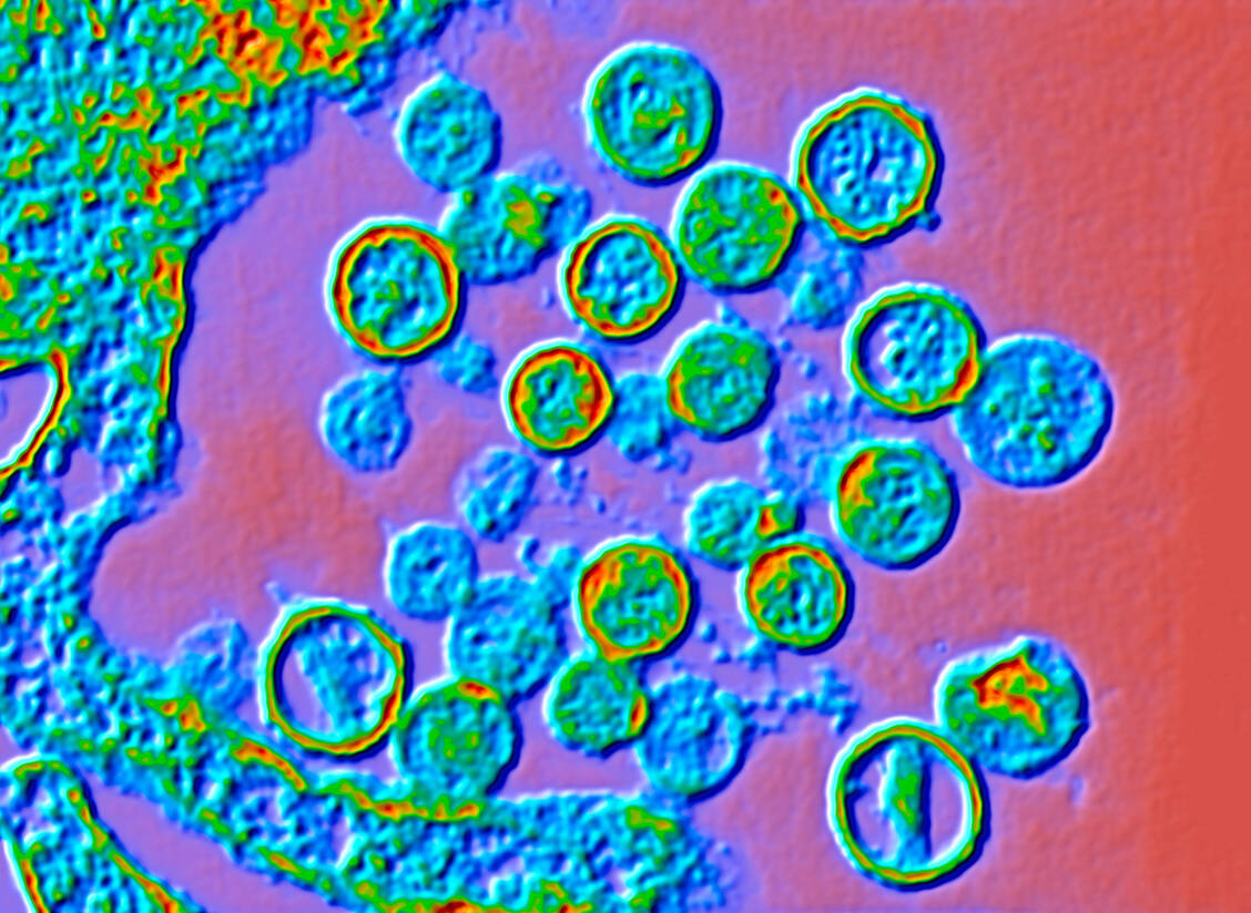 Bei den beiden Kreuzfahrt-Passagieren, die nach einer Infektion mit einem Hantavirus von einer Atlantikkreuzfahrt nach Südafrika ausgeflogen wurden, wurde der Andes-Typ der Virengruppe festgestellt. / © Science Photo Library/Getty Images