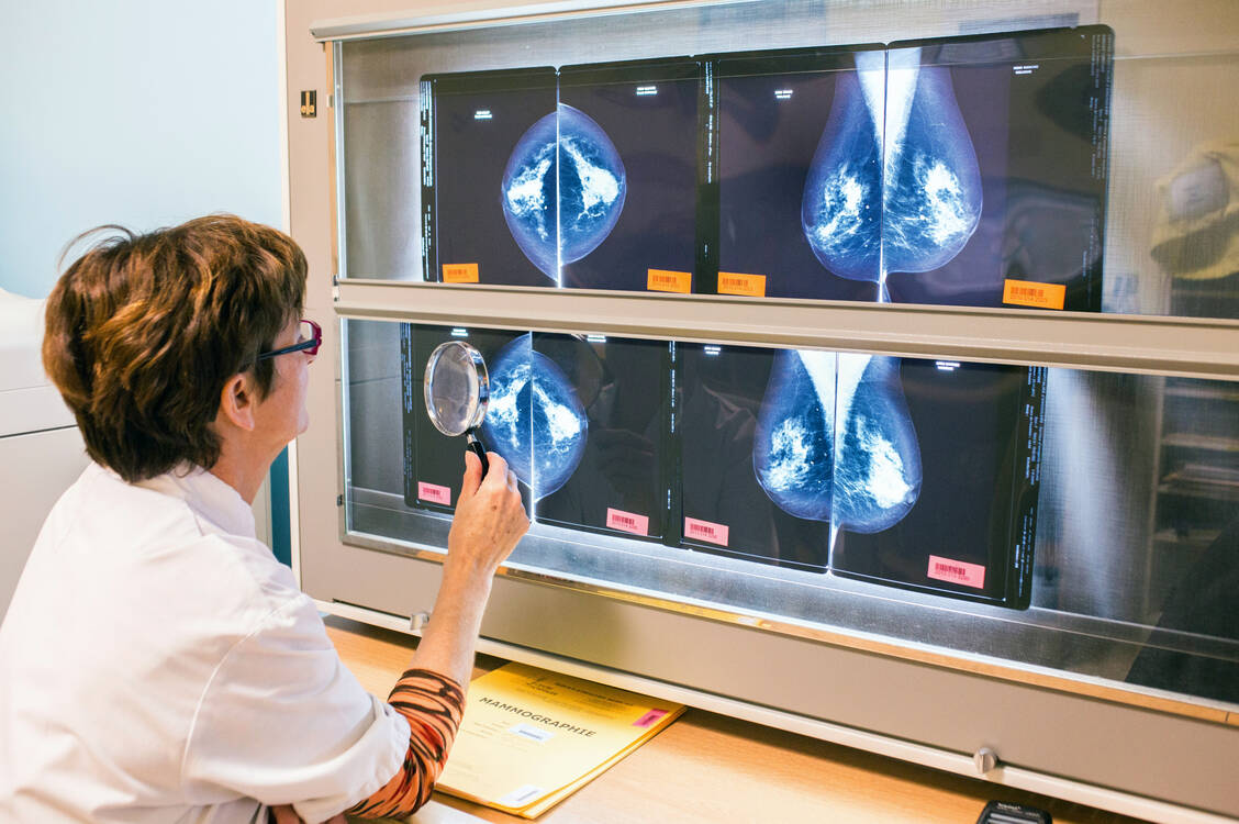 Eine Mammografie korrekt auszuwerten, kann sehr schwierig sein. Immer wieder kommt es auch zu falsch positiven oder falsch negativen Befunden. / Foto: Superbild