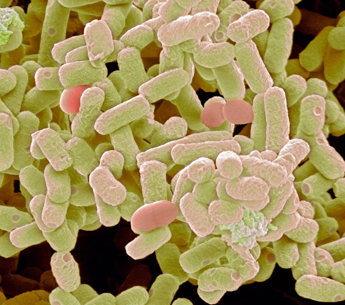 Escherichia coli kann Biofilme ausbilden, die etwa Harnwegsinfekt äußerst therapieresistent machen. / Foto: picture alliance/Science Photo Library