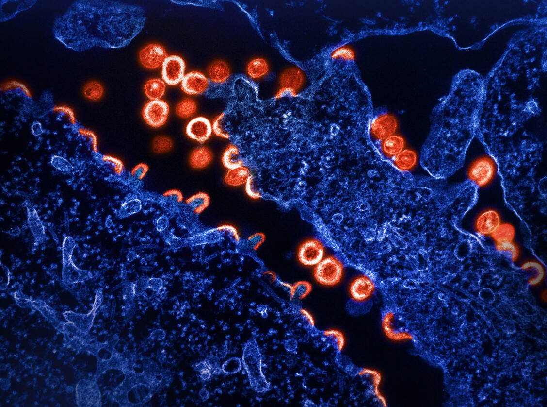 Transmissionselektronenmikroskopische Aufnahme einer HIV-infizierten Zelle (blau). Zu sehen ist die Knospung des Virus (rot). / Foto: NIAID