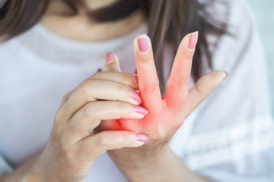 Nur mit Karenz von Allergenen und Irritanzien heilt ein Handekzem nicht ab. Eine gute Basispflege und eine medikamentöse Therapie sind unumgänglich. / Foto: Getty Images/Siriporn Kaenseeya/EyeEm