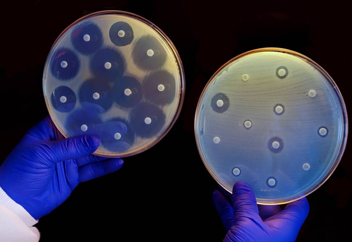 Die zunehmenden Resistenzen gegen Antibiotika stellen ein wachsendes Problem der modernen Medizin dar. Offenbar sind Bakterien beim Austausch von Resistenzgenen sehr gewieft. / Foto: Imago/United Archives International