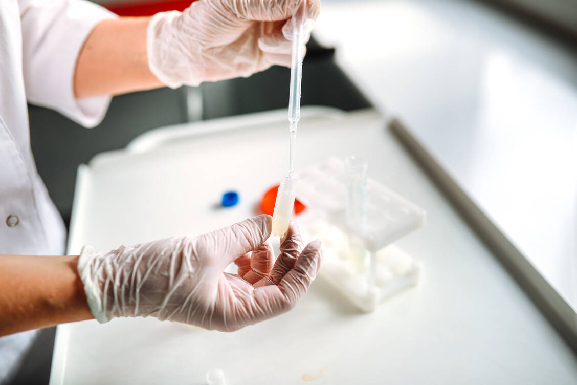 Peptidfragmente im Sperma bilden Amyloide, die Mpox-Viren das das Andocken an menschliche Zellen erleichtern. / © Getty Images/Natalia Lebedinskaia
