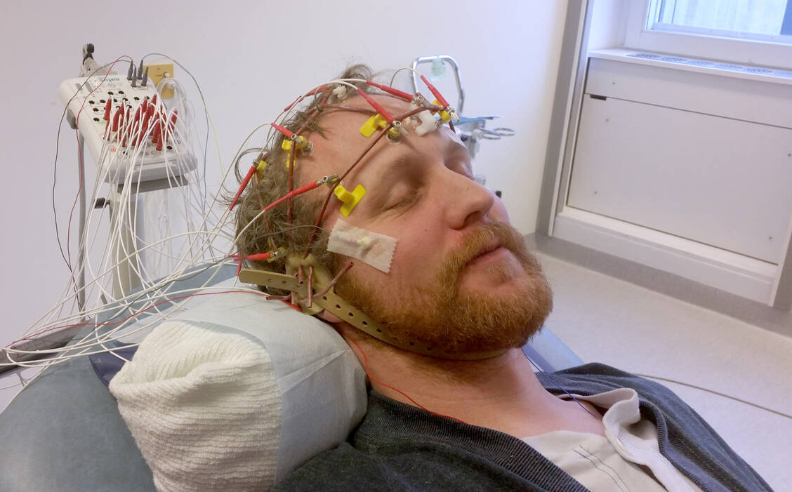 Antikonvulsiva kommen nicht nur bei Epilepsie, sondern in vielen Indikationen zum Einsatz. / Foto: Adobe Stock/marcus leidner/EyeEm