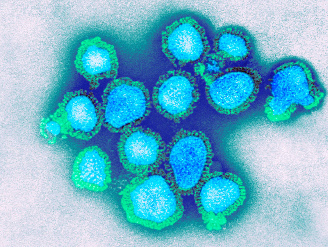 Ein H1N1-Stamm ist durch zwei Mutationen im Neuraminidase-Gen unempfindlich gegen Neuraminidase-Inhibitoren geworden.  / Foto: Getty Images/CDC/Science Photo Library