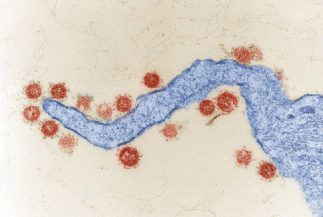 Das Coronavirus SARS-CoV-2 schreitet in seiner Evolution weiter voran. Nun ist die Variante XEC aufgetaucht, die sich von den JN.1-Abkömmlingen KS.1.1 und KP.3.3 ableitet. / Foto: Hans R. Gelderblom, Freya Kaulbars/RKI