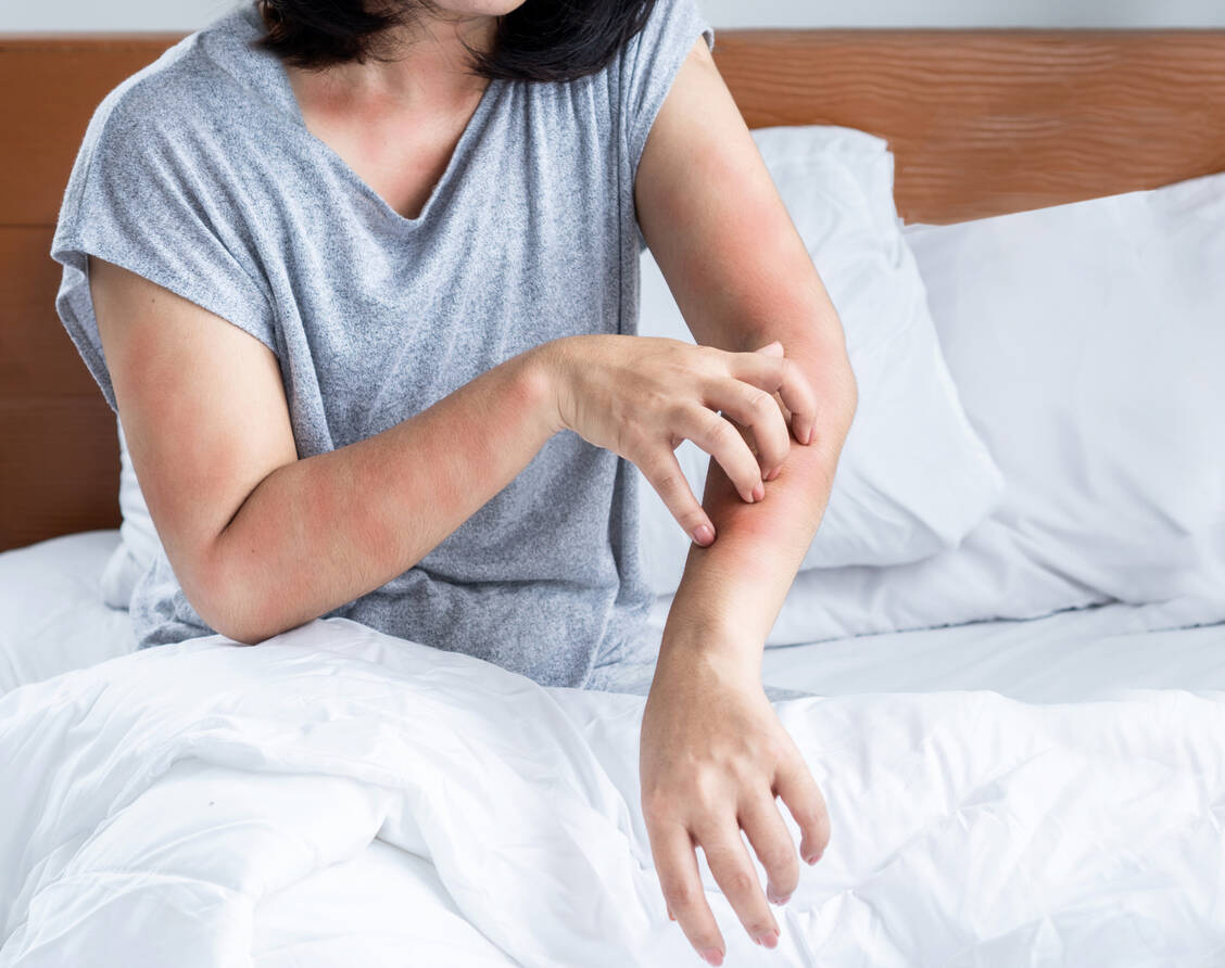 Vor allem Frauen erkranken an primär biliärer Cholangitis. Die Symptome sind unspezifisch. Sehr häufig tritt starker Juckreiz auf. / © Adobe Stock/doucefleur