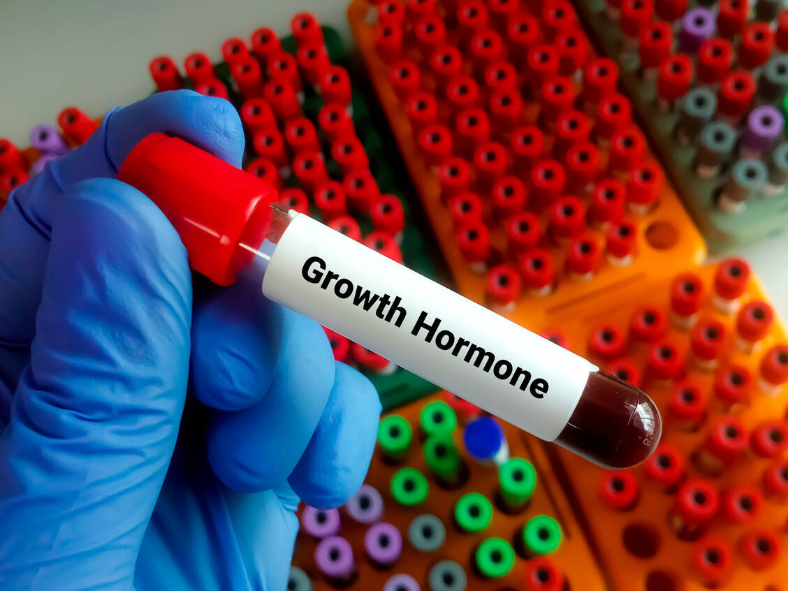 Ein Wachstumshormonmangel (Growth Hormone Deficiency, GHD) ist eine seltene Erkrankung, die im Kindes-, aber auch erst im Erwachsenenalter auftreten kann. / Foto: Adobe Stock/Saiful52