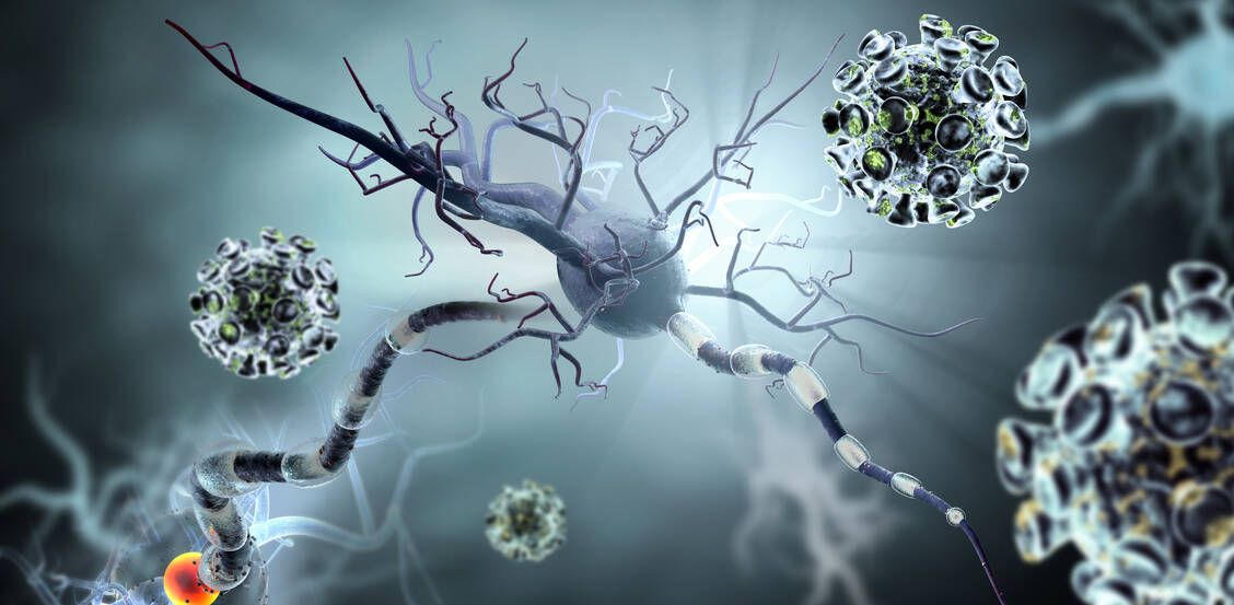 S1P-Rezeptor-Modulatoren wie Ozanimod verhindern, dass Lymphozyten die Lymphknoten verlassen und ins  zentrale Nervensystem eindringen, wo sie die Myelinscheiden angreifen können. / Foto: Adobe Stock/ralwel