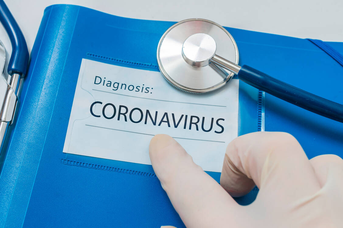 Wie sicher ist die Diagnose? Antikörpertests können trügen, warnt die WHO. / Foto: ©vchalup - stock.adobe.com