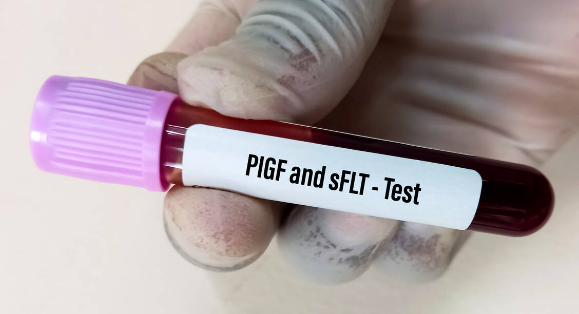 Die Bestimmung des sFlt1/PLGF-Quotienten im mütterlichen Blut ist eine sehr präzise Methode, um zu prüfen, ob eine Präeklampsie vorliegt. / © Getty Images/Md Babul Hosen