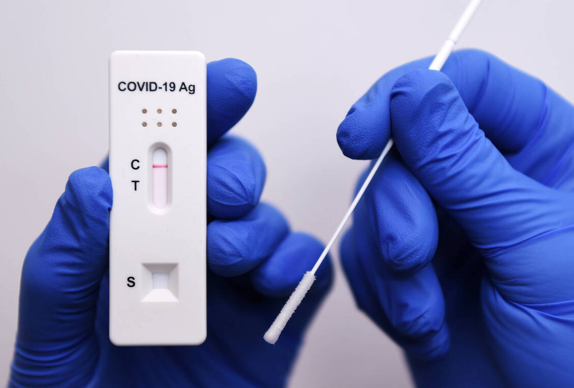 Die Durchführung der Coronavirus-Schnelltests entweder zuhause in Eigenanwendung oder durch professionelle Anwender wird auch nach der Pandemie weiter möglich sein. / Foto: Imago/ULMER Pressebildagentur