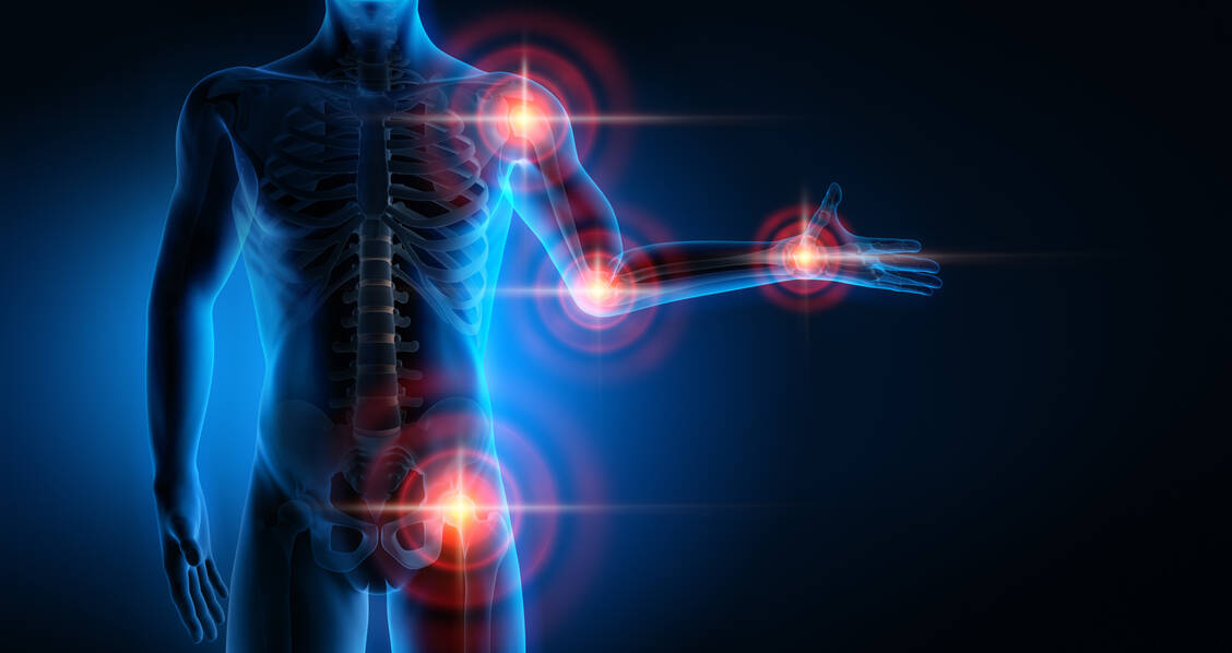 Chronische Entzündungen spielen bei einer Reihe von häufigen Erkrankungen eine wichtige Rolle. Zwei Substanzen, die in den Entzündungsprozess eingreifen, sind in der Klinik angekommen. / Foto: Adobe Stock/peterschreiber.media