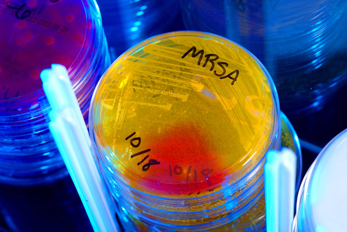 Immer mehr bakterielle Erreger werden gegen gängige Antibiotika resistent. Doch der Markt ist klein und unattraktiv. Deshalb haben sich immer mehr Unternehmen aus der Forschung in diesem Bereich verabschiedet. Jetzt will eine Initiative Geld für die Forschung  bündeln und das Thema auch politisch voranbringen. Denn die Bedrohung durch multresistente Erreger wächst.  / Foto: CDC/Melissa Dankel/James Gathany