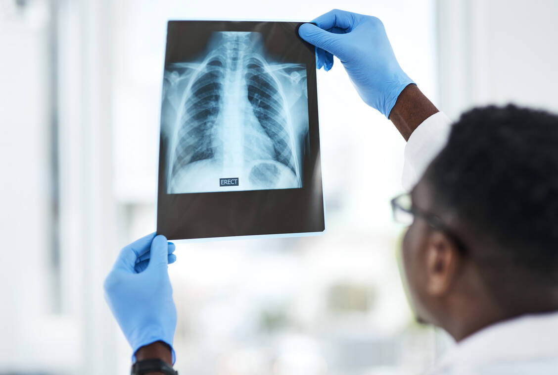 Zur Diagnose einer Tuberkulose gehört auch ein Röntgenbild. Doch zu wenig Menschen weltweit haben derzeit Zugang zu Tests und Therapie. / Foto: Getty Images/PeopleImages
