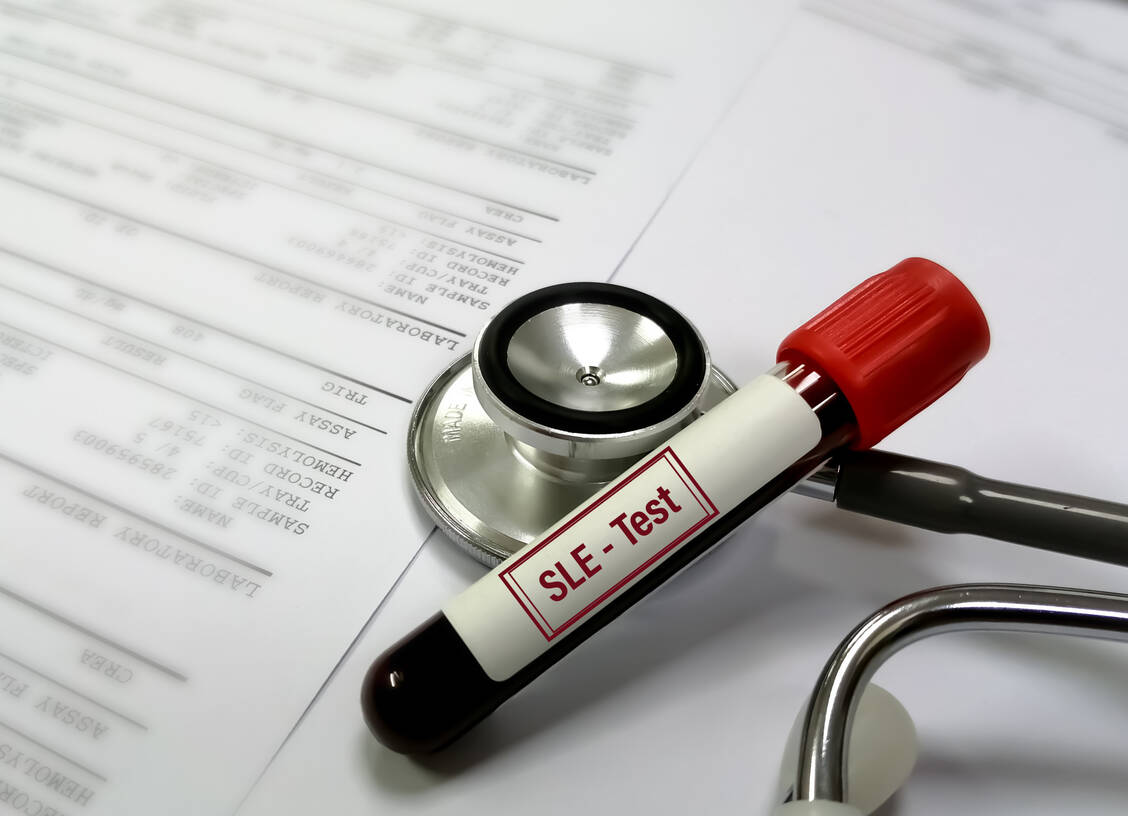 Eine aktuelle Studie bringt neue immunologische Details zur Pathogenese des systemischen Lupus erythematodes ans Licht. Entscheidend beteiligt ist demnach ein Ungleichgewicht zwischen verschiedenen Arten von T-Helferzellen. / Foto: Getty Images/Md Saiful Islam Khan