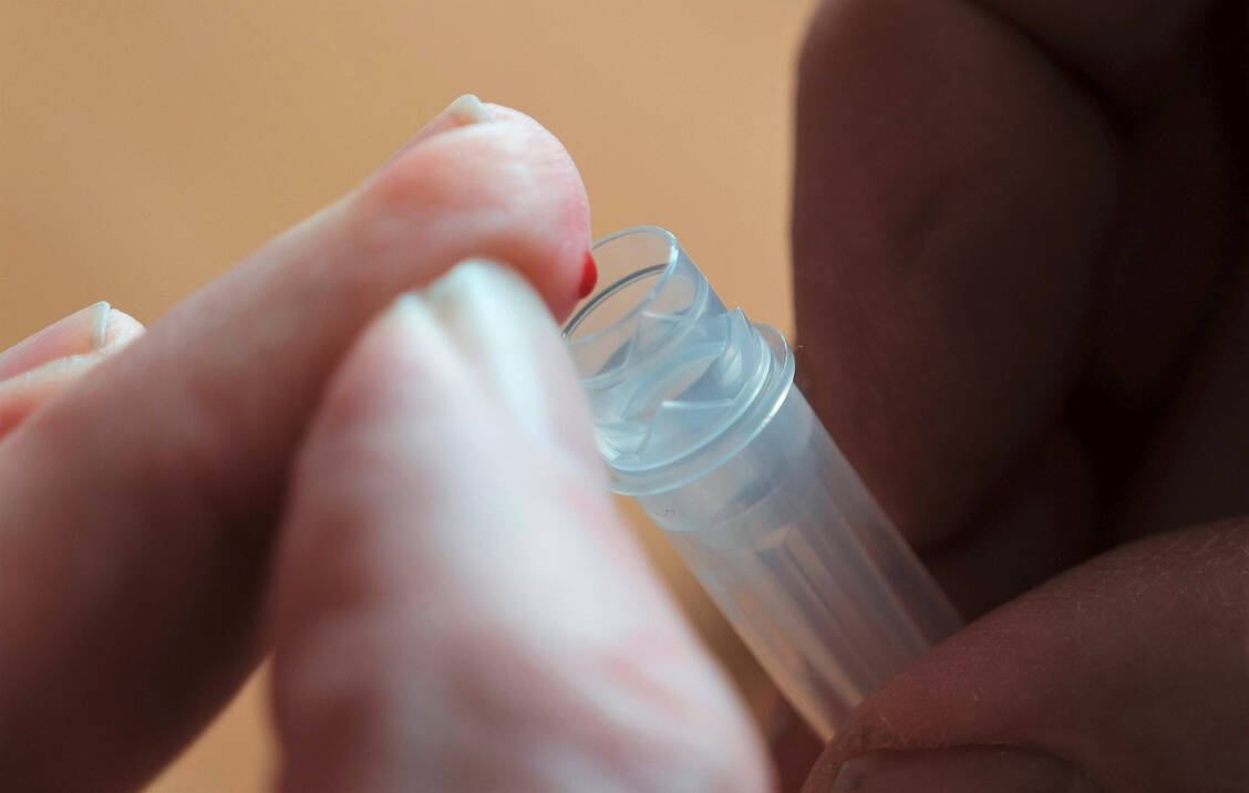 Für Antikörper-Schnelltests wird etwas Blut aus der Fingerbeere entnommen.  / Foto: Imago Images/Hartenfelser