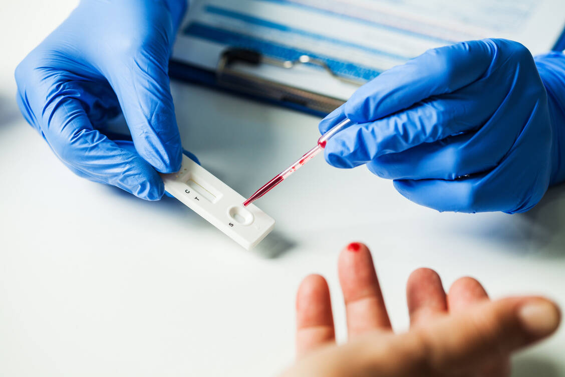 Die Schnelltests auf SARS-CoV-2-Antikörper sehen aus wie die bekannten Antigen-Schnelltests, erfordern aber statt eines Nasen-Rachen-Abstrichs einen Tropfen Kapillarblut. / Foto: Adobe Stock/Milos