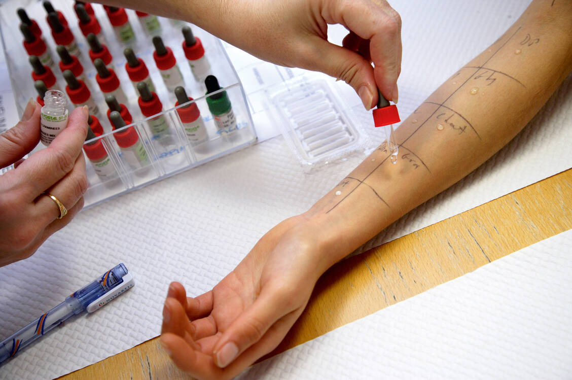 Ein Allergietest ist für Patienten mit vermuteter Penicillin-Allergie sinnvoll, damit sie im Zweifelsfall nicht unnötig mit einem Reserveantibiotikum behandelt werden. / Foto: Superbild