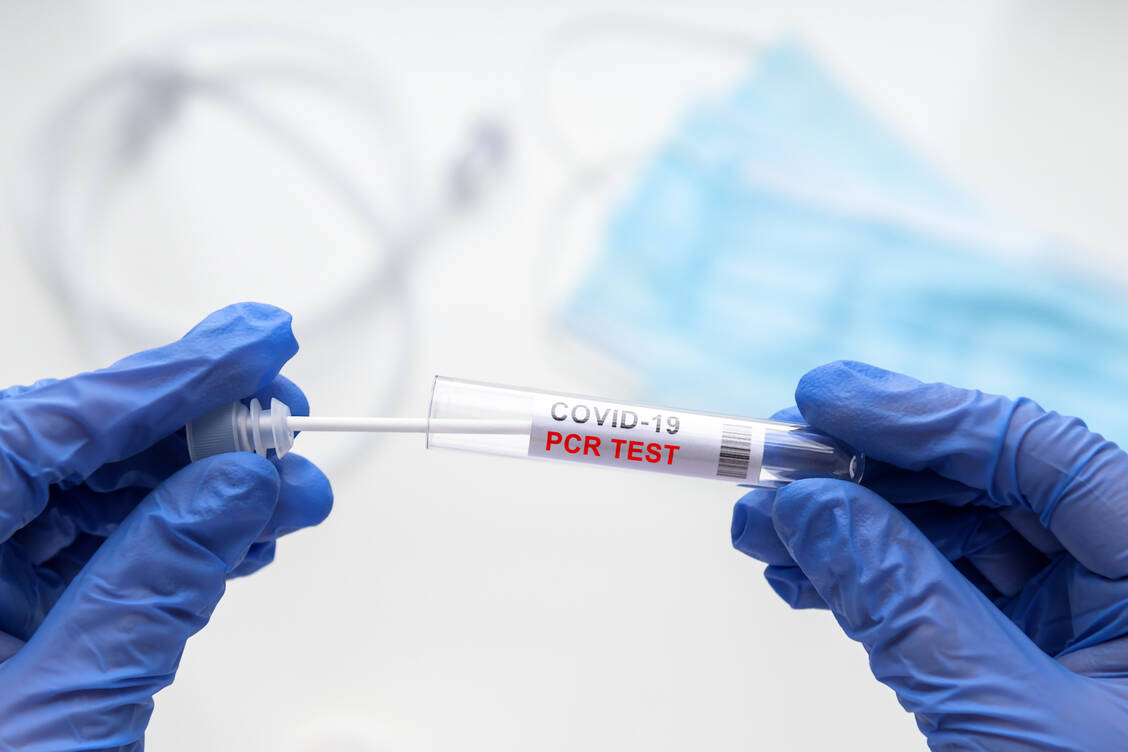 Das vollständige Viruserbgut wird nur bei einem sehr kleinen Anteil positiver PCR-Test-Proben untersucht. / Foto: Adobe Stock/Viacheslav Lopatin