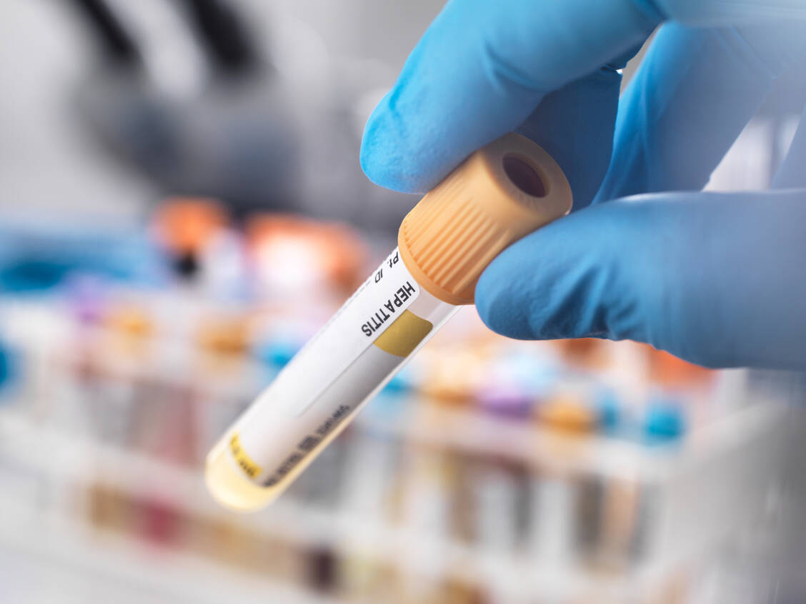 Mehr Tests und vor allem Prophylaxe-Maßnahmen sind nötig, um sexuell übertragbare Erkrankungen einzudämmen. / © Getty Images/Westend61/Andrew Brookes