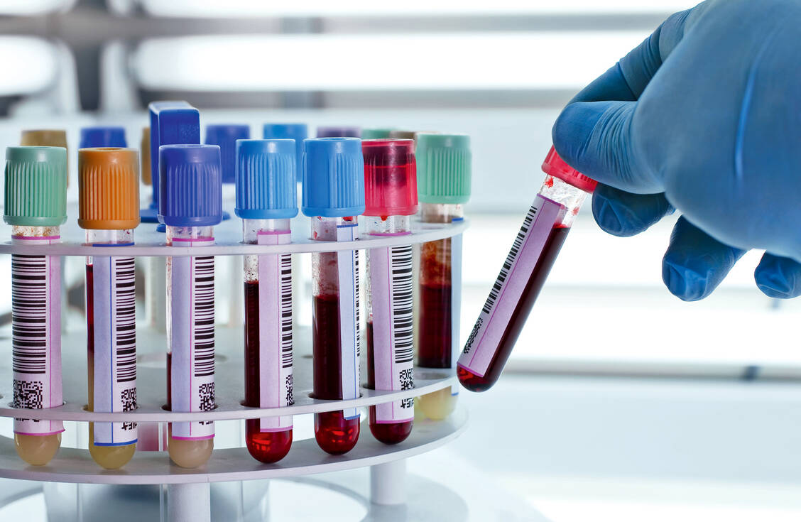 Im Blut von Personen, die noch keinen Kontakt mit dem SARS-CoV-2-Virus hatten, kommen T-Zellen vor, die dieses erkennen können. / Foto: Fotolia/angellodeco