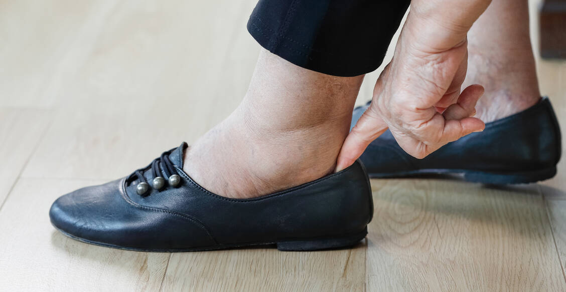 Wegen einer verminderten Schmerzwahrnehmung empfinden Diabetiker mit einer sensiblen Neuropathie zu kleine Schuhe als angenehm. / Foto: Getty Images/Toa55