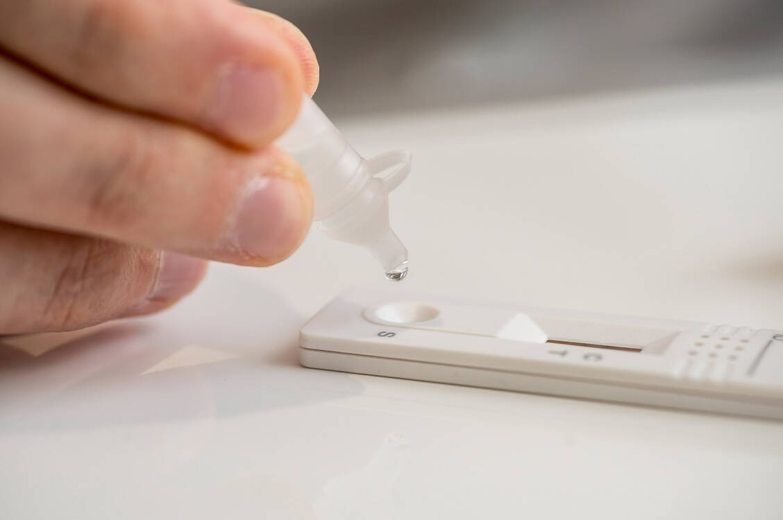 Bestimmte Schnelltests sollen künftig in der Apotheke durchgeführt werden.  / © Technomed/Foto Fischer