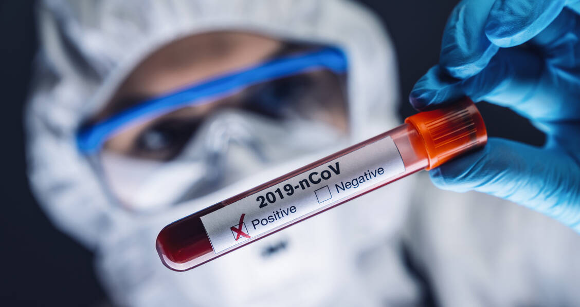 Auch wenn die Antikörpertiter nach einer durchgemachten SARS-CoV-2-Infektion sinken, bleibt das Virus dem Körper wohl doch im immunologischen Gedächtnis. / Foto: Adobe Stock/rcfotostock