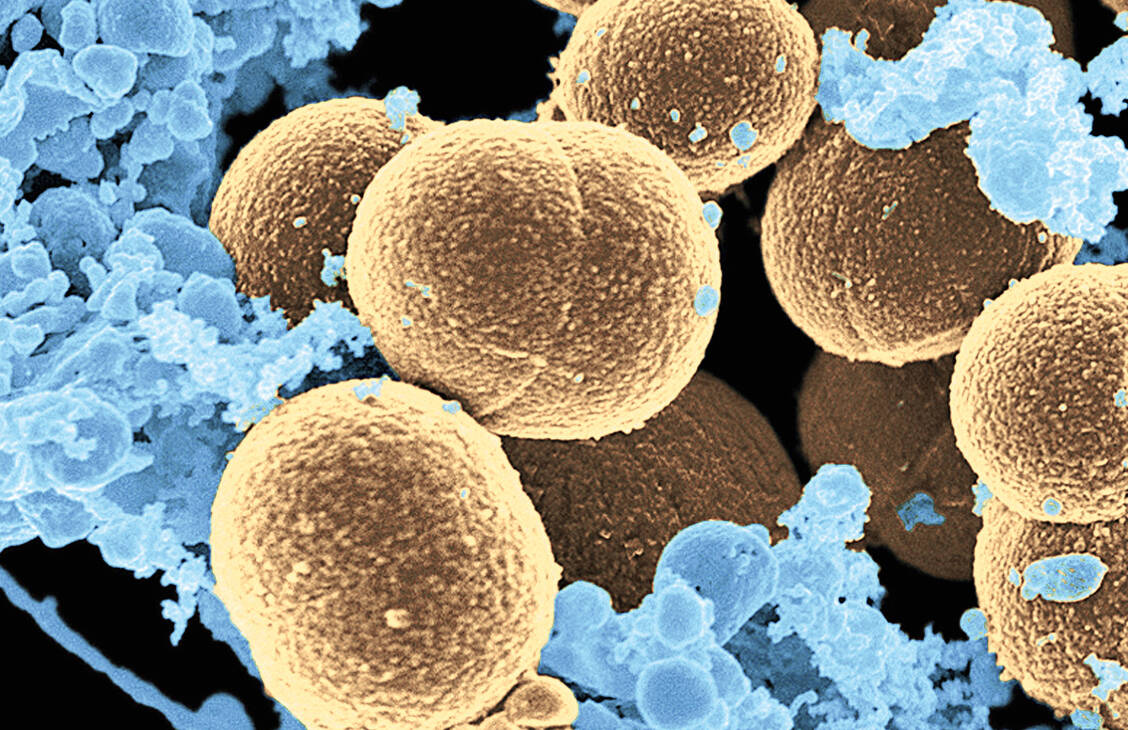 Für die Abwehr von MRSA und anderen Bakterien ist eine gute Funktion der Neutrophilen Granulozyten wichtig. Sie könnte durch ACE-Hemmer in Mitleidenschaft gezogen werden. / Foto: CDC/Frank DeLeo (NIAID)