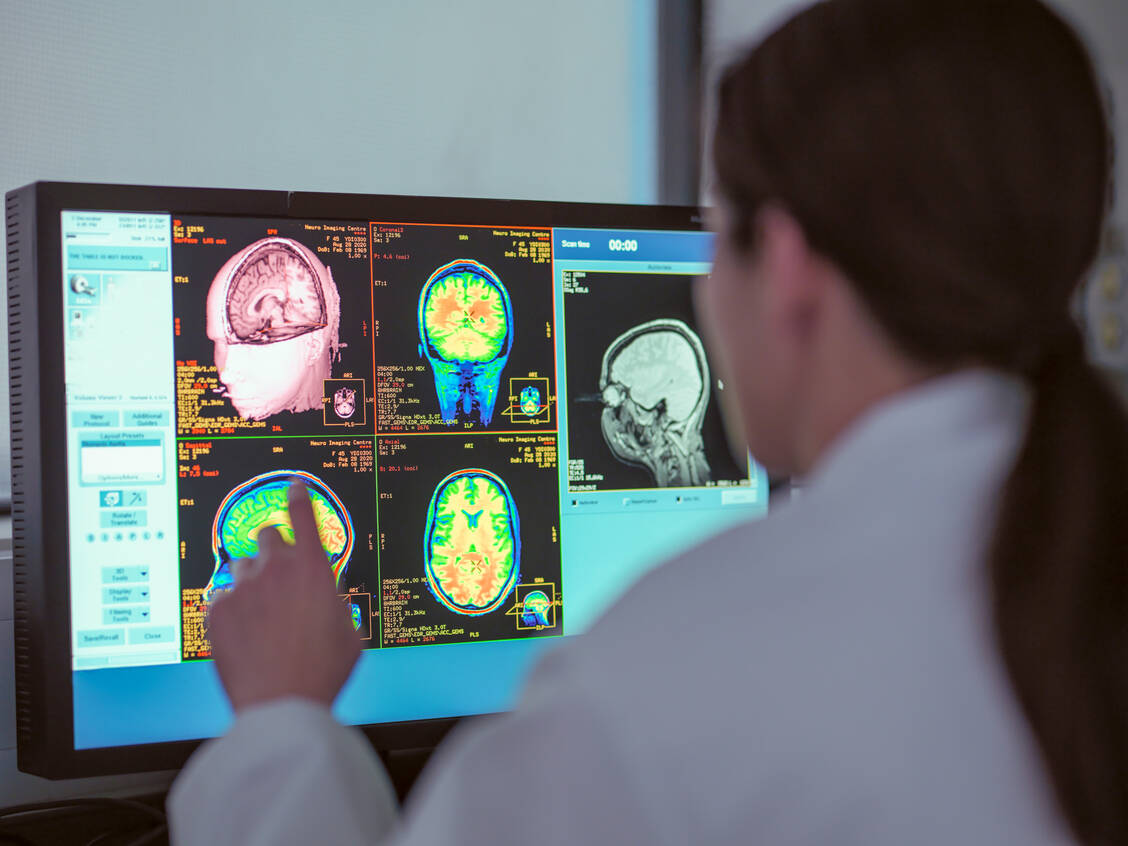 Eine neue Studie hat das komplexe Zusammenspiel von genetischen, lebensstilbedingten und pathologischen Faktoren bei der Alterung des Gehirns mittels MRT untersucht. / Foto: Getty Images/Monty Rakusen