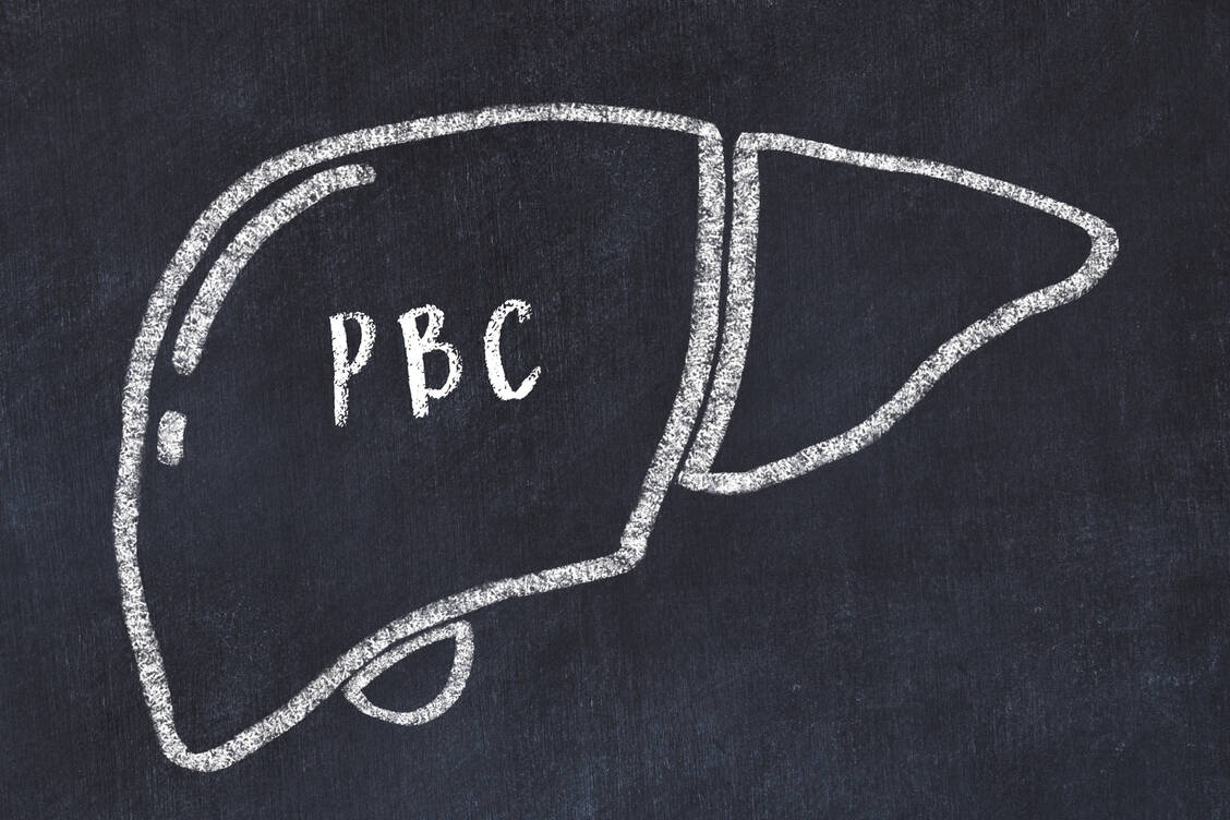 Die primäre biliäre Cholangitis, kurz PBC, ist eine seltene, autoimmun vermittelte, chronisch entzündliche Lebererkrankung. / Foto: Adobe Stock/ iushakovsky
