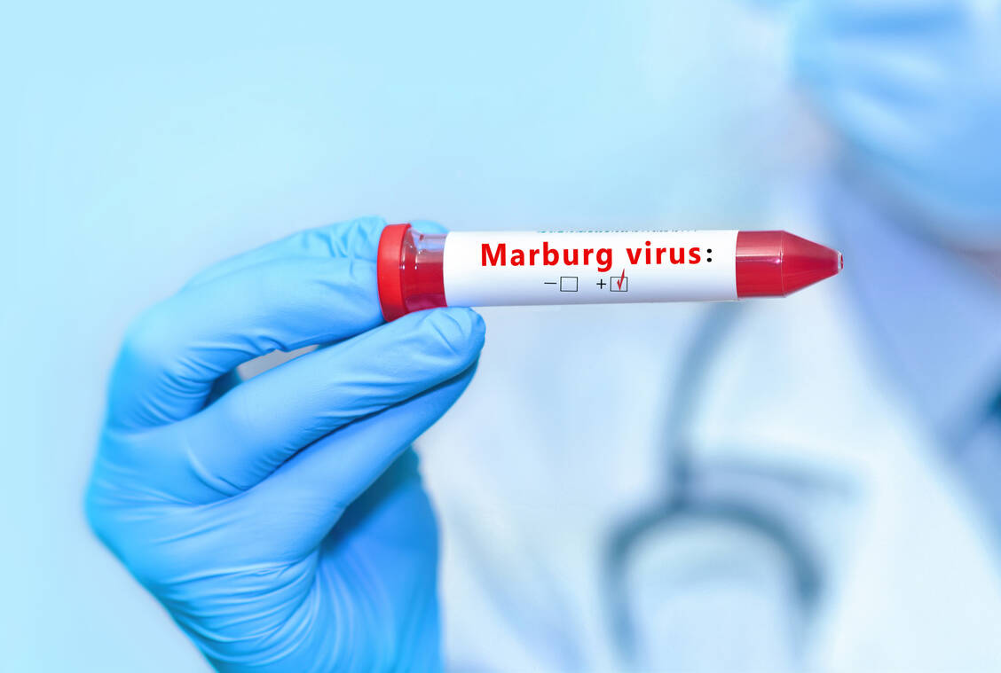 In Äquatorialguinea sind inzwischen neun Infektionen mit dem Marburg-Virus bestätigt worden. / Foto: Adobe Stock/Suhina Marina