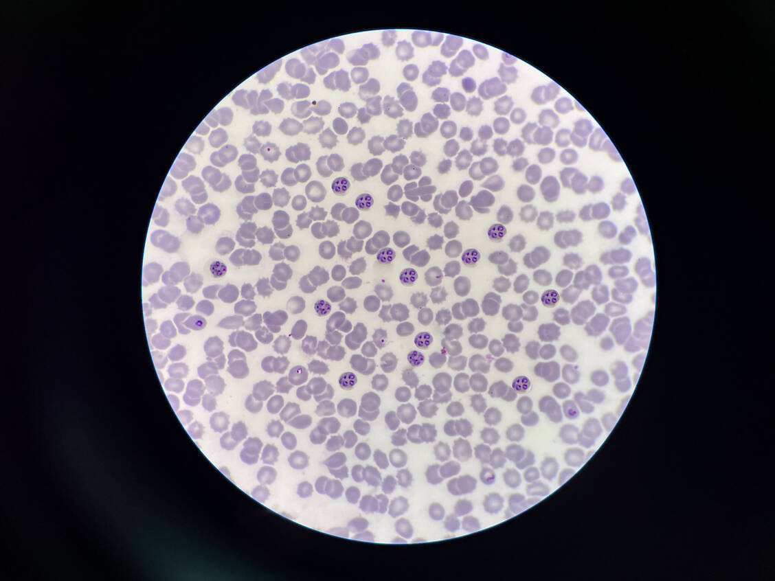 Plasmodien sind Parasiten mit einem komplizierten Lebenszyklus, in dessen Verlauf sie rote Blutkörperchen infizieren. / © Imago Images/Depositphotos