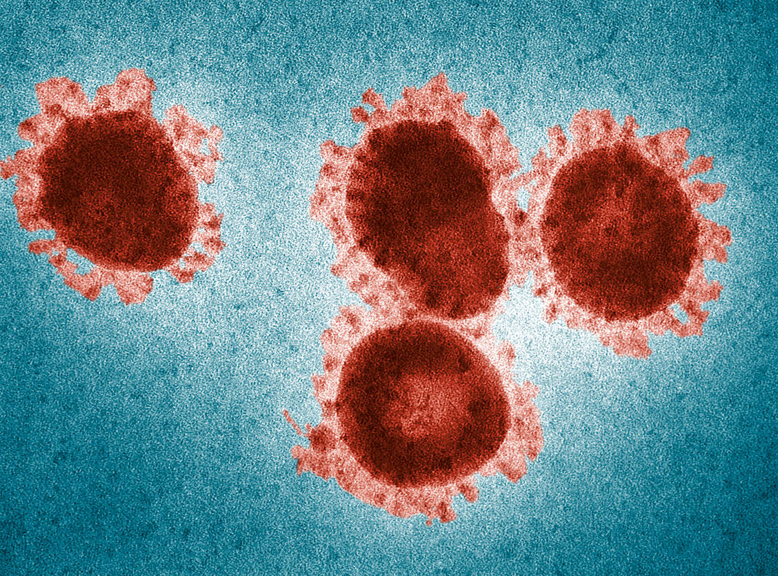 Coronaviren, zu denen auch das MERS- und der SARS-Erreger zählen, zeichnen sich durch einen Kranz aus Hüllproteinen aus, die auf Mikroskop-Aufnahmen zu erkennen sind. / Foto: CDC/Fred Murphy