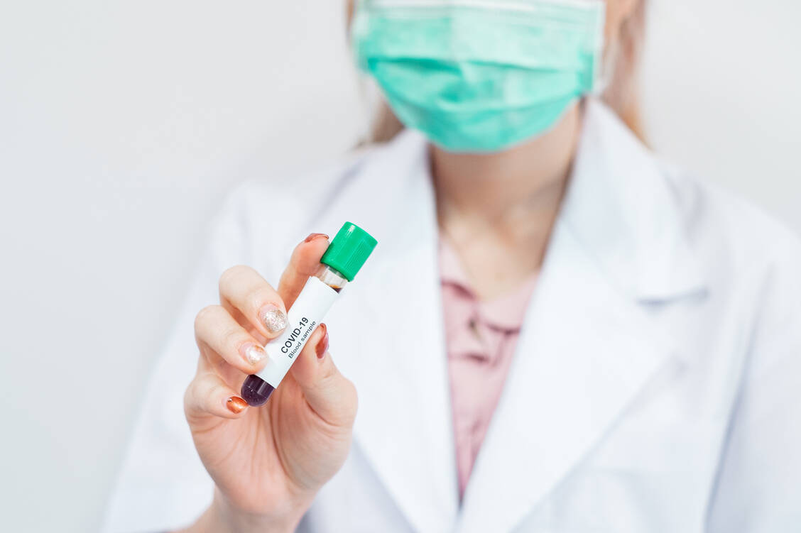 Die Unikliniken in Deutschland wollen erforschen, was eine Covid-19-Infektion langfristig bei den Betroffenen anrichten kann. Dazu sollen auch regelmäßig Blutproben untersucht werden. / Foto: Getty Images/Taechit Taechamanodom