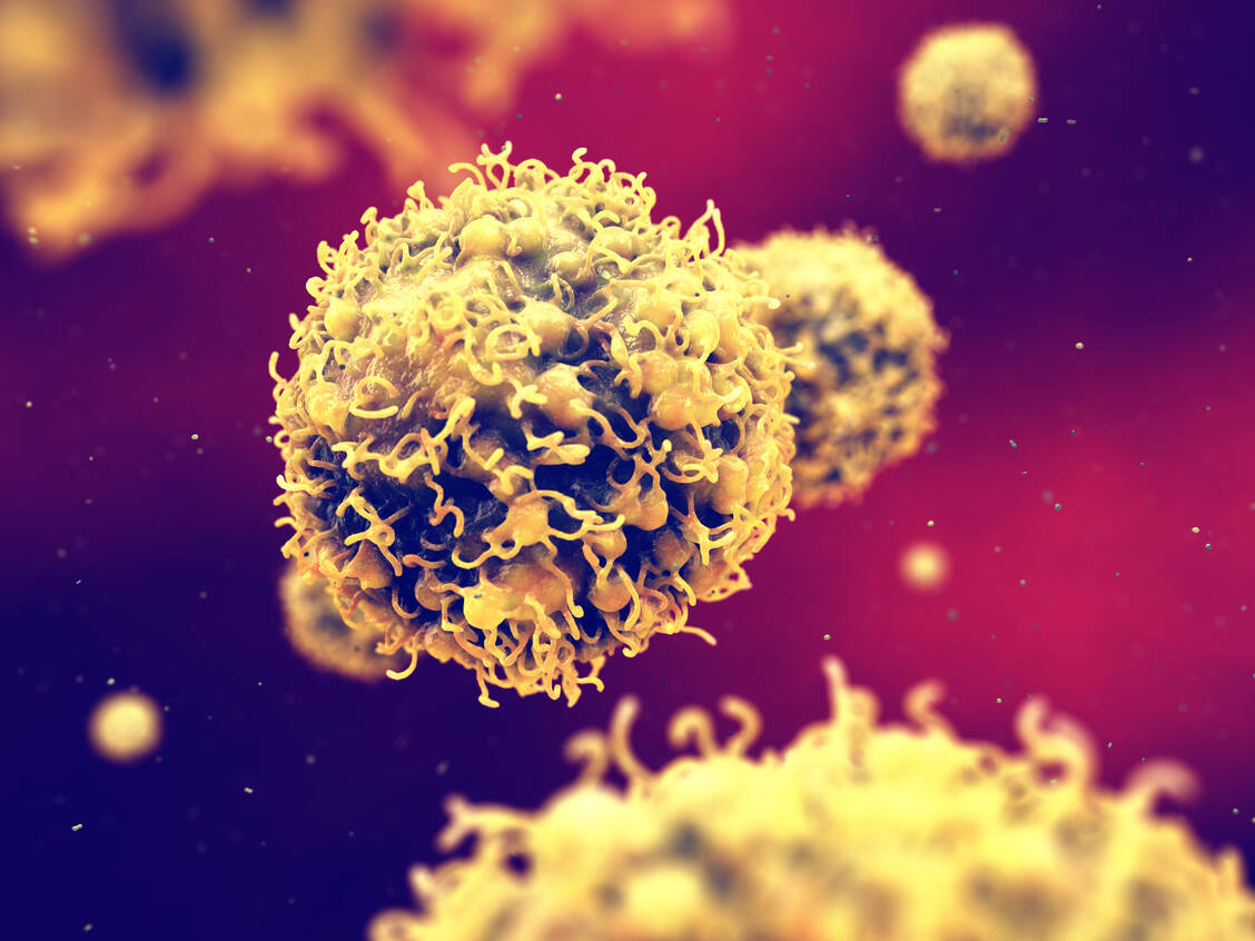 Krebszellen exprimieren vermehrt die wachstumsfördernde Phosphatase PPM1F, welche diese zu einem vielversprechenden Arzneistoff-Angriffspunkt in der Krebstherapie macht.  / Foto: Adobe Stock/nobeastsofierce