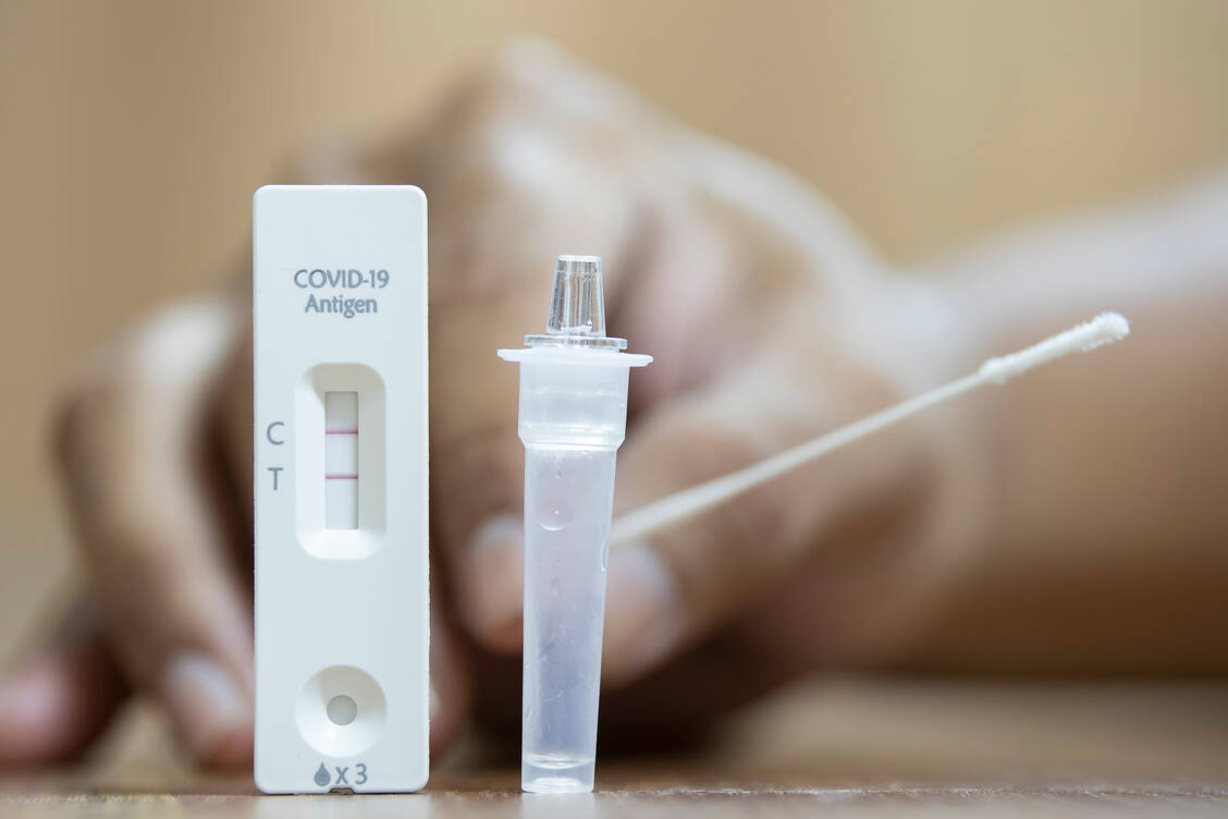Eine Reihe von Covid-19-Tests wird wohl in den kommenden Monaten wieder positiv ausfallen. Eine Bedrohung stellt der Anstieg der Fallzahlen deutschen Experten zufolge aber nicht dar. / Foto: Getty Images/Songphol Thesakit
