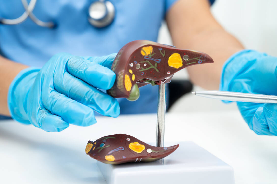 In den USA ist Semaglutid bereits seit einiger Zeit bei metabolisch-assoziierter Steatohepatitis (MASH) zugelassen. In der EU wird das Inkretinmimetikum bei dieser Fettlebererkrankung aller Voraussicht nach auch bald zum Einsatz kommen dürfen. / © Adobe Stock/Warawan