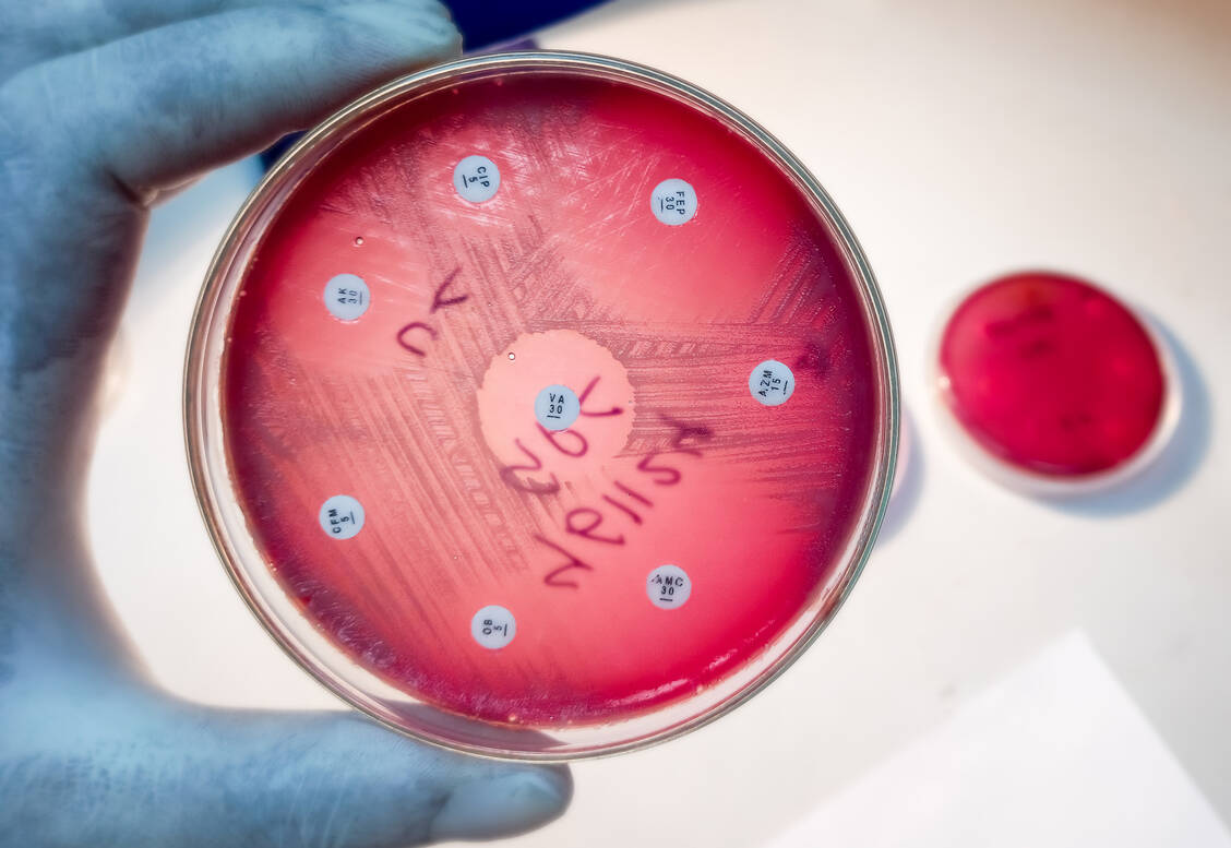 Welches Antibiotikum wirkt noch zuverlässig gegen welchen Erreger? Über ein digitales Tool können Ärzte nun aktuelle Informationen zur Resistenzlage abrufen. / © Getty Images/Md Babul Hosen