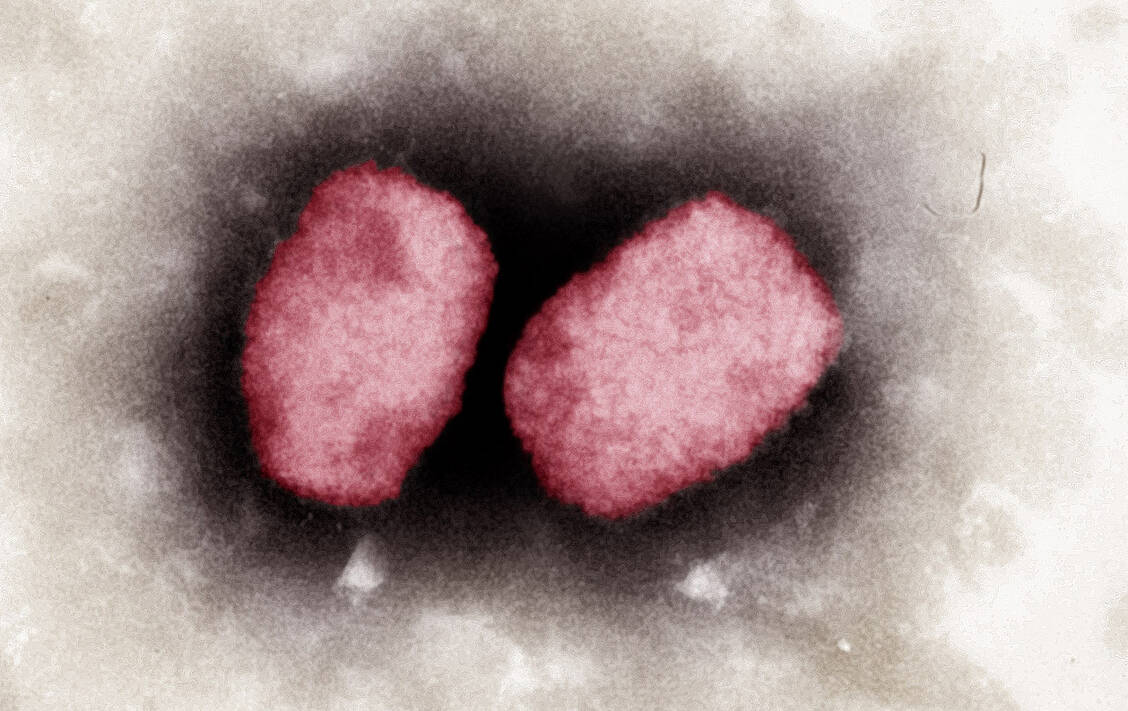 Affenpocken werden ausgelöst durch das Affenpockenvirus Orthopoxvirus simiae (auch Monkeypox virus, MPXV) aus der Gattung Orthopoxvirus. / Foto: RKI/Andrea Männel, Andrea Schnartendorff