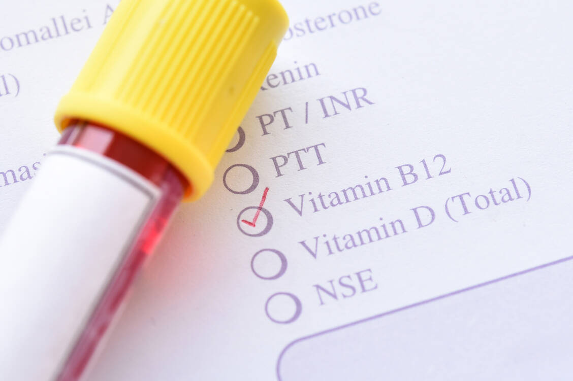 Einem Vitamin-B12 -Mangel können verschiedene Ursachen zugrunde liegen: Die Zufuhr kann ungenügend, die Aufnahme reduziert oder der Bedarf erhöht sein. / Foto: Adobe Stock/jarun011