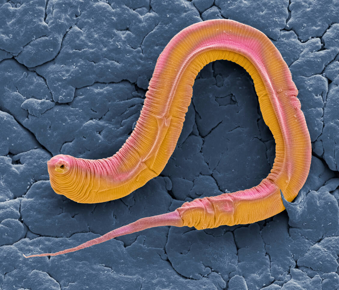 Der Wurm Caenorhabditis elegans ist ein von Alterungsforschern vielgenutzter Modellorganismus. / Foto: Steven Gschmeissner/Science Photo Library