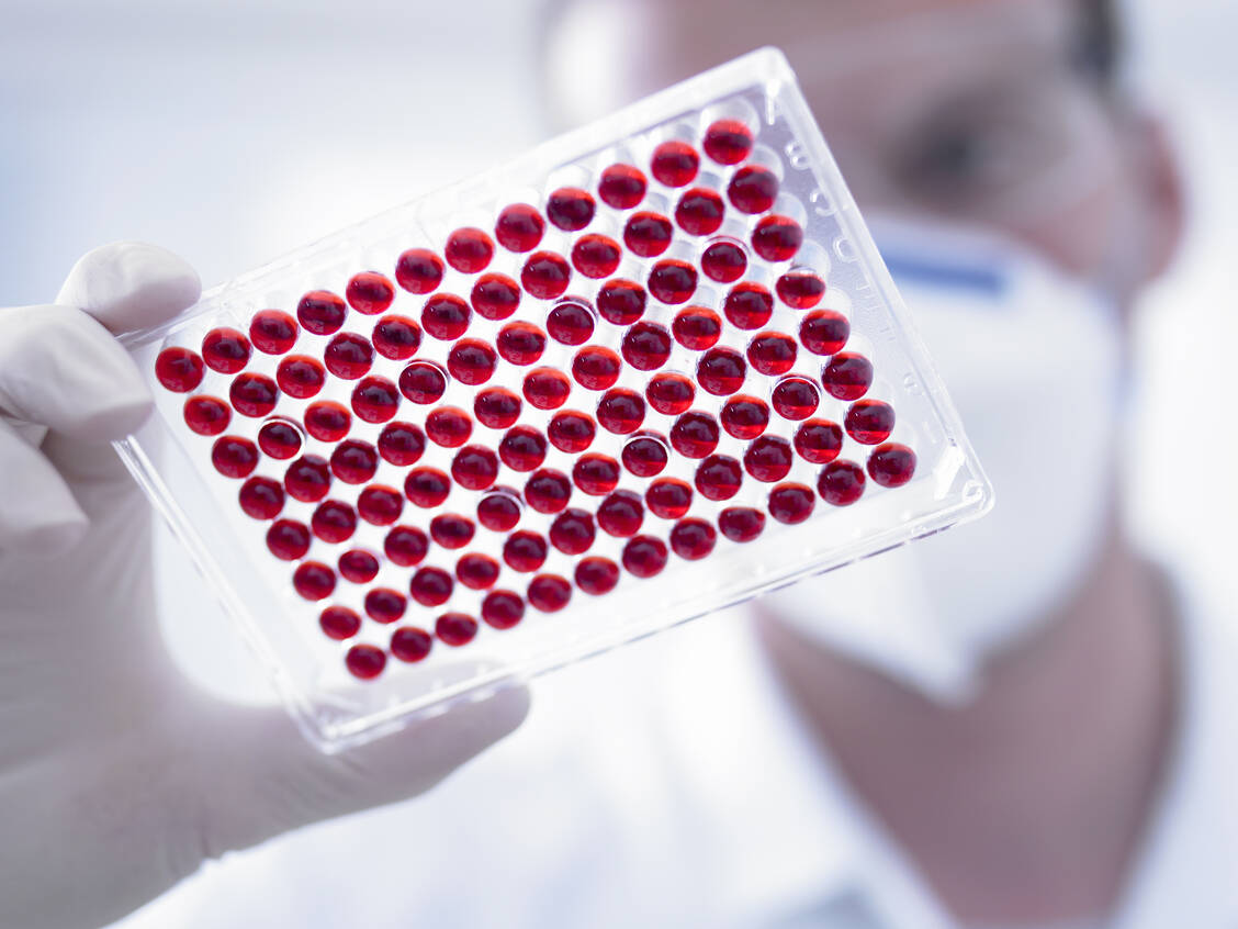 Das Blut von jungen Tieren scheint Faktoren zu enthalten, die verjüngend auf Nervenzellen wirken. / Foto: Getty Images/
Adam Gault