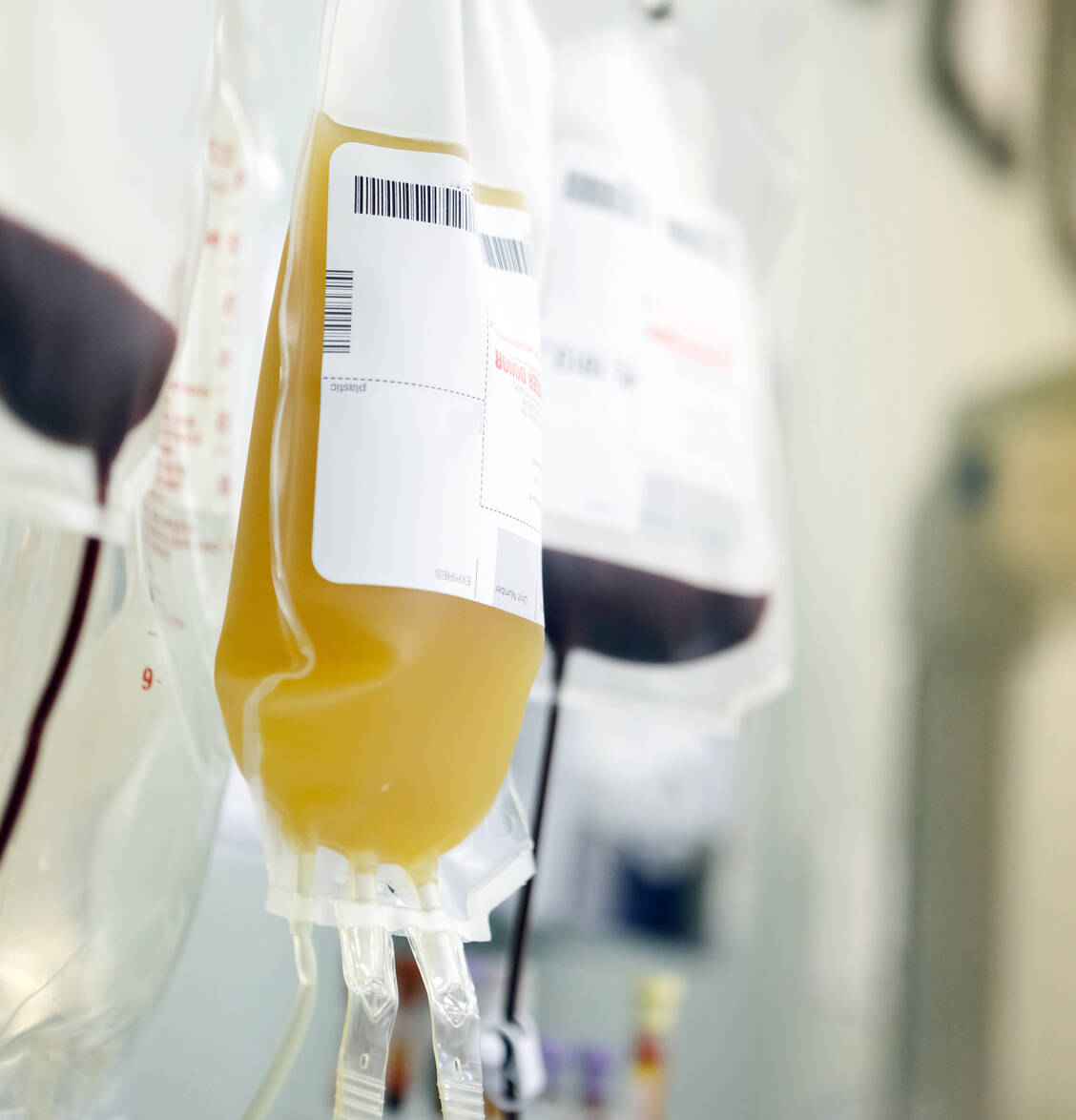 Vollblut, Plasma, Erythrozyten- und Thrombozytenkonzentrate erfüllen unterschiedliche Aufgaben. / © Getty Images/P_Wei