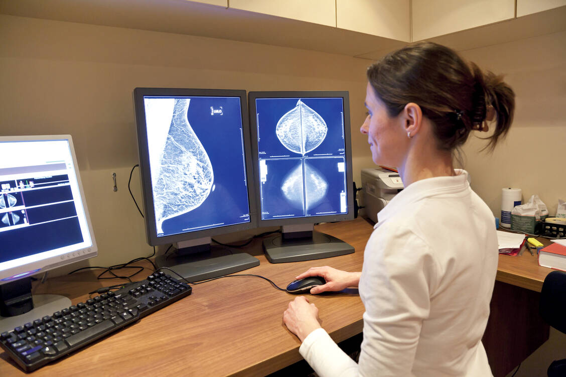 Die Mammografie zählt zu den Standardverfahren zur Früherkennung von Brustkrebs. / Foto: Adobe Stock/Picture Partners