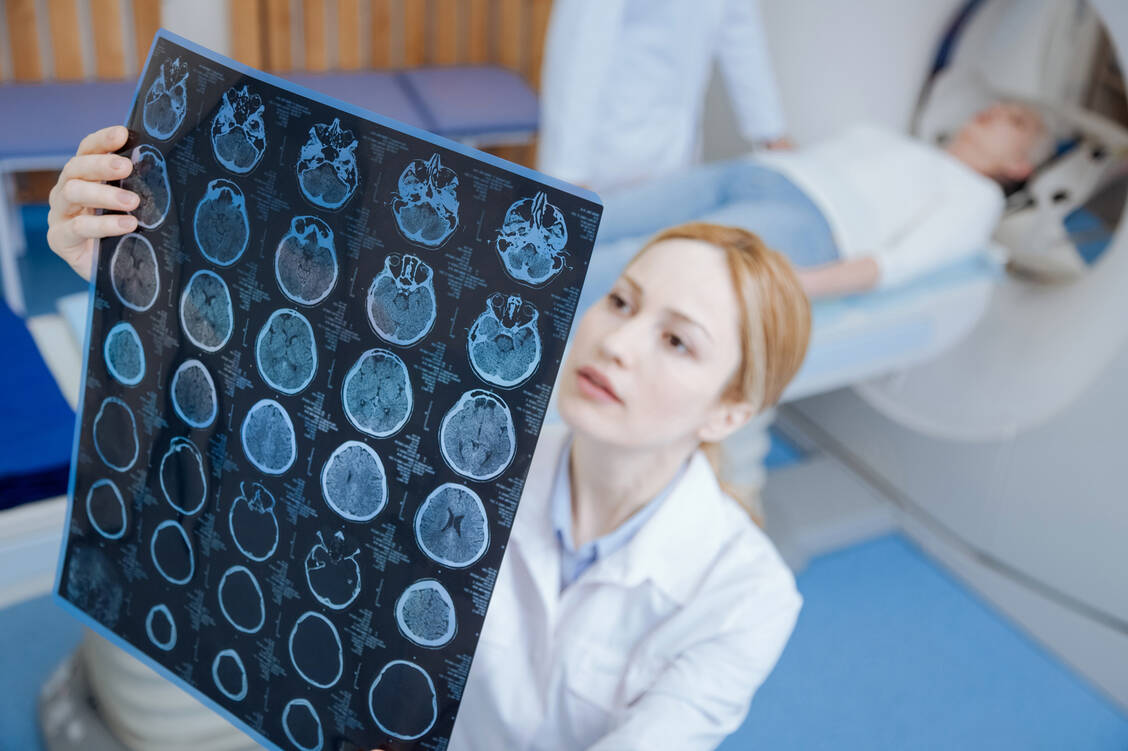Für die Studie unterzogen sich die Teilnehmer einem Hirnscan (Symbolbild). / Foto: Adobe Stock/zinkevych