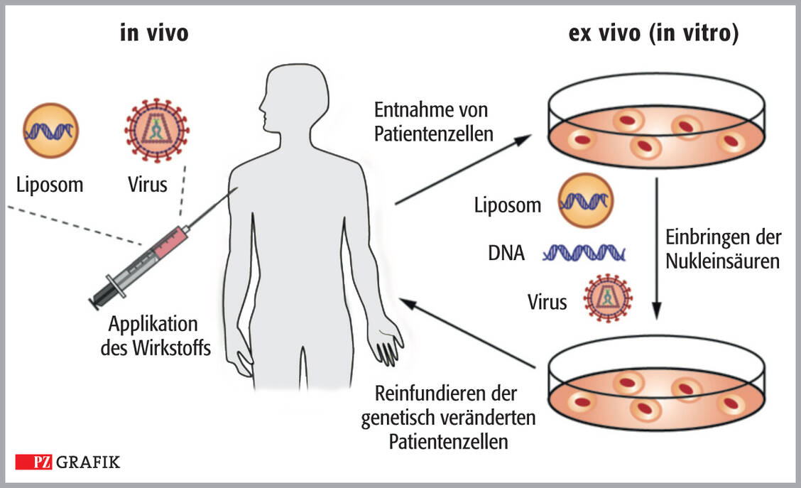 Abbildung 3: Prinzip der Gentherapie: Um Körperzellen eines Patienten genetisch zu modifizieren, kann man die neukombinierte DNA mittels Liposomen oder Viren in den Körper einbringen (In-vivo-Gentherapie, linke Seite). Glybera® und Luxturna® nutzen dieses Prinzip. Alternativ (rechts im Bild) können Körperzellen entnommen, ex vivo genetisch verändert und anschließend wieder reinfundiert werden. Strimvelis®, Kymriah® und Yescarta® funktionieren so. / Foto: I. Zündorf