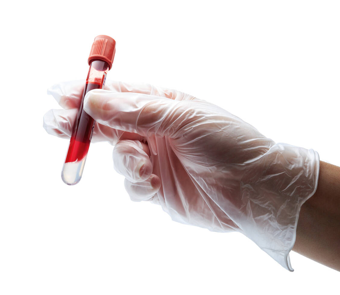 Wenn die Blutgerinnung mangels spezifischer Faktoren nicht funktioniert, müssen die Patienten mitunter lebenslang Faktorenkonzentrate injizieren, um Spontanblutungen zu verhindern.  / Foto: Fotolia/Romolo Tavani